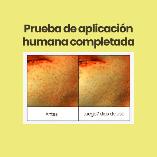 AMPLE:N Sérum Facial Despigmentante (50 ml)
