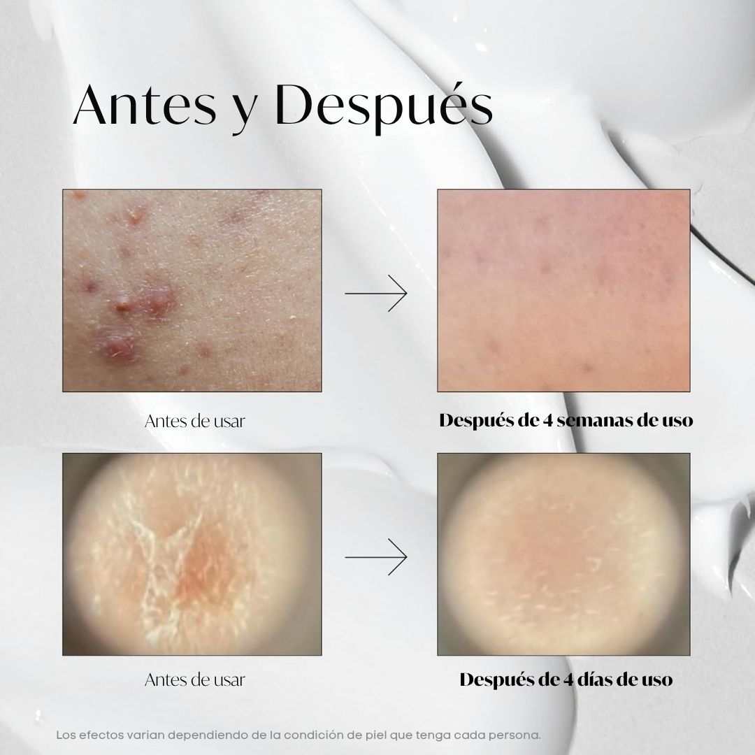 VT Cosmetics «VT Reedle Shot 100»